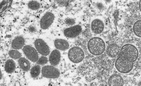 電子顕微鏡で撮影されたサル痘ウイルス（米疾病対策センター提供）（ＡＦＰ時事）