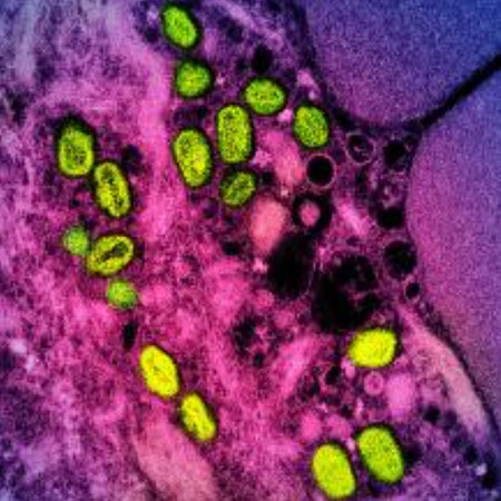 着色され緑色に見えるサル痘ウイルスの電子顕微鏡写真＝撮影日不明、米国立アレルギー・感染症研究所（ＮＩＡＩＤ）提供（ＡＦＰ時事）