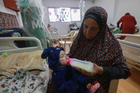 ５日、パレスチナ自治区ガザ南部ラファの医療施設で手当てを受ける栄養失調の子供（ＡＦＰ時事）